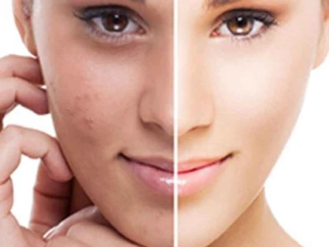 Undecylenoyl Phenylalanine Powder Application 2